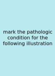 Mark The Pathologic Condition For The Following Illustration