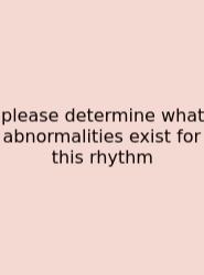 Please Determine What Abnormalities Exist For This Rhythm
